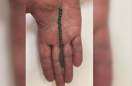 Опасна мода: Деца поглъщат магнитни топчета заради предизвикателство в TikTok